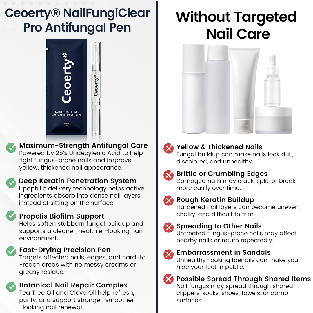 Ceoerty® NailFungiClear Pro Antifungal Pen (A)