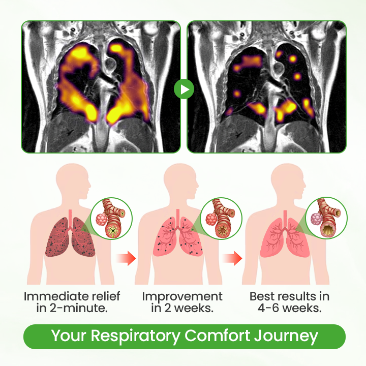 Timilk® HerbaAir Mullein Lung Purifier (A)