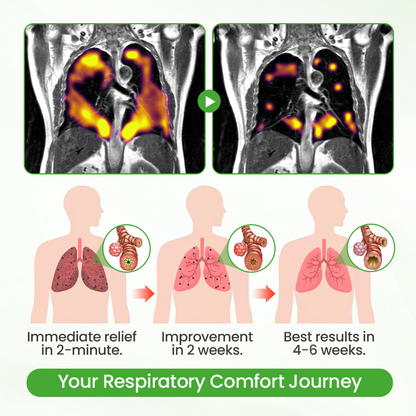 Timilk® HerbaAir Mullein Lung Purifier (A)