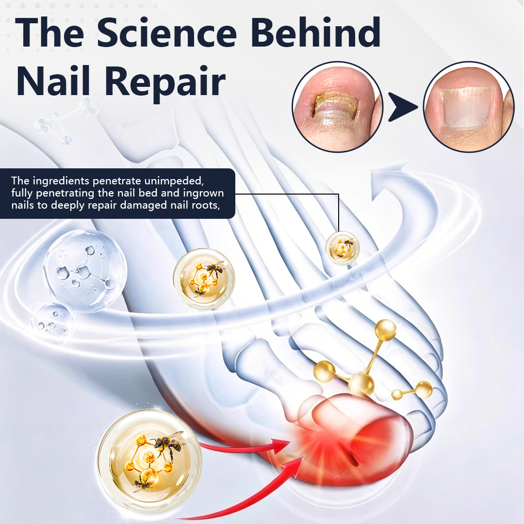 Ceoerty® NailFungiClear Pro Antifungal Pen (A)