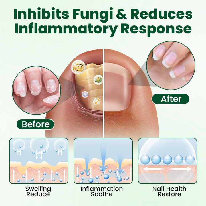 Timilk® Nail Repair Nourish Gel (A)