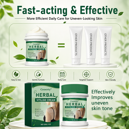 Ceoerty® Herbal Vitiligo Cream (A)