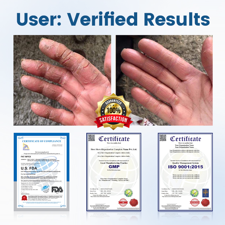 Timilk® AngioVita Diabetic Care Spray（A）