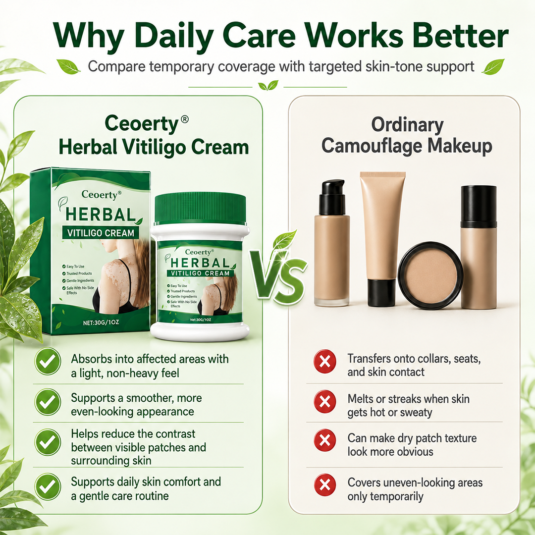 Ceoerty® Herbal Vitiligo Cream (A)
