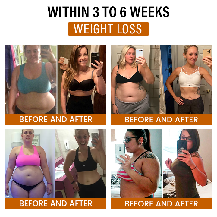 Timilk® SlimFlow Bee Venom Lymphatic Detox Foot Patches（A）