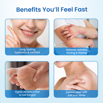 Timilk® MagnesiumHerb Psoriasis Relief Cream (A)