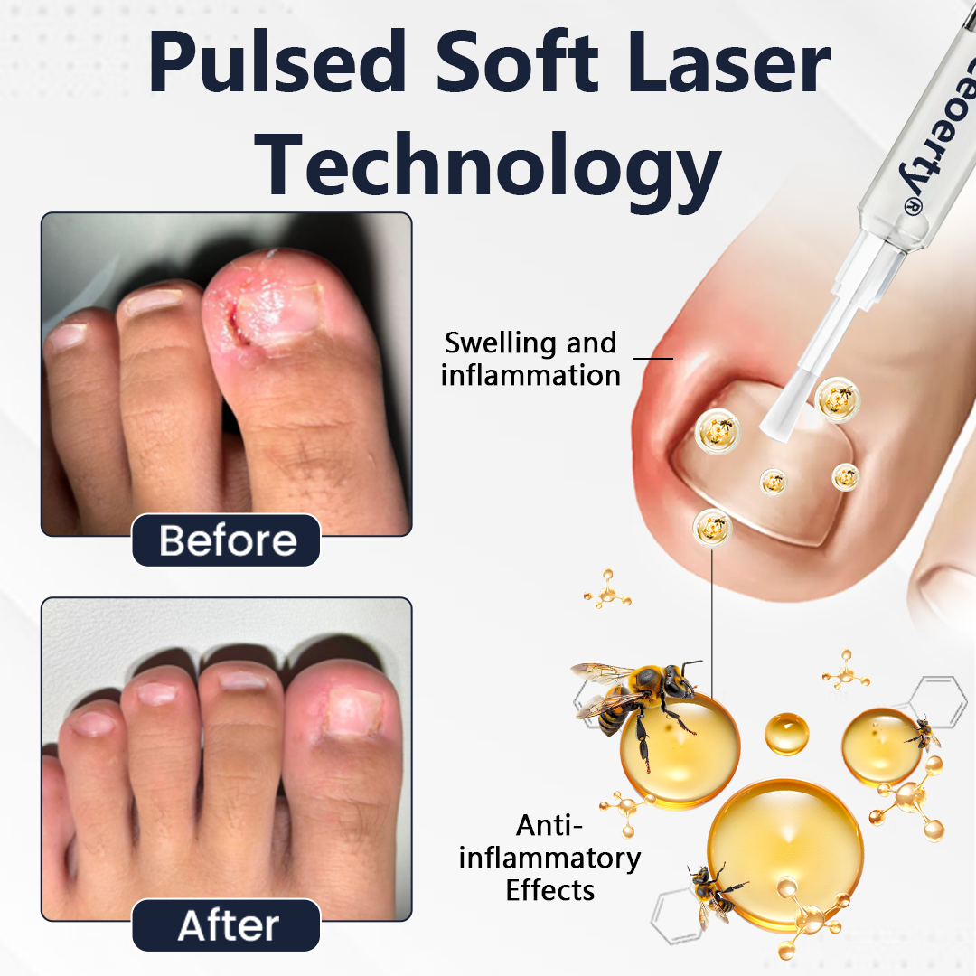 Ceoerty® NailFungiClear Pro Antifungal Pen (A)