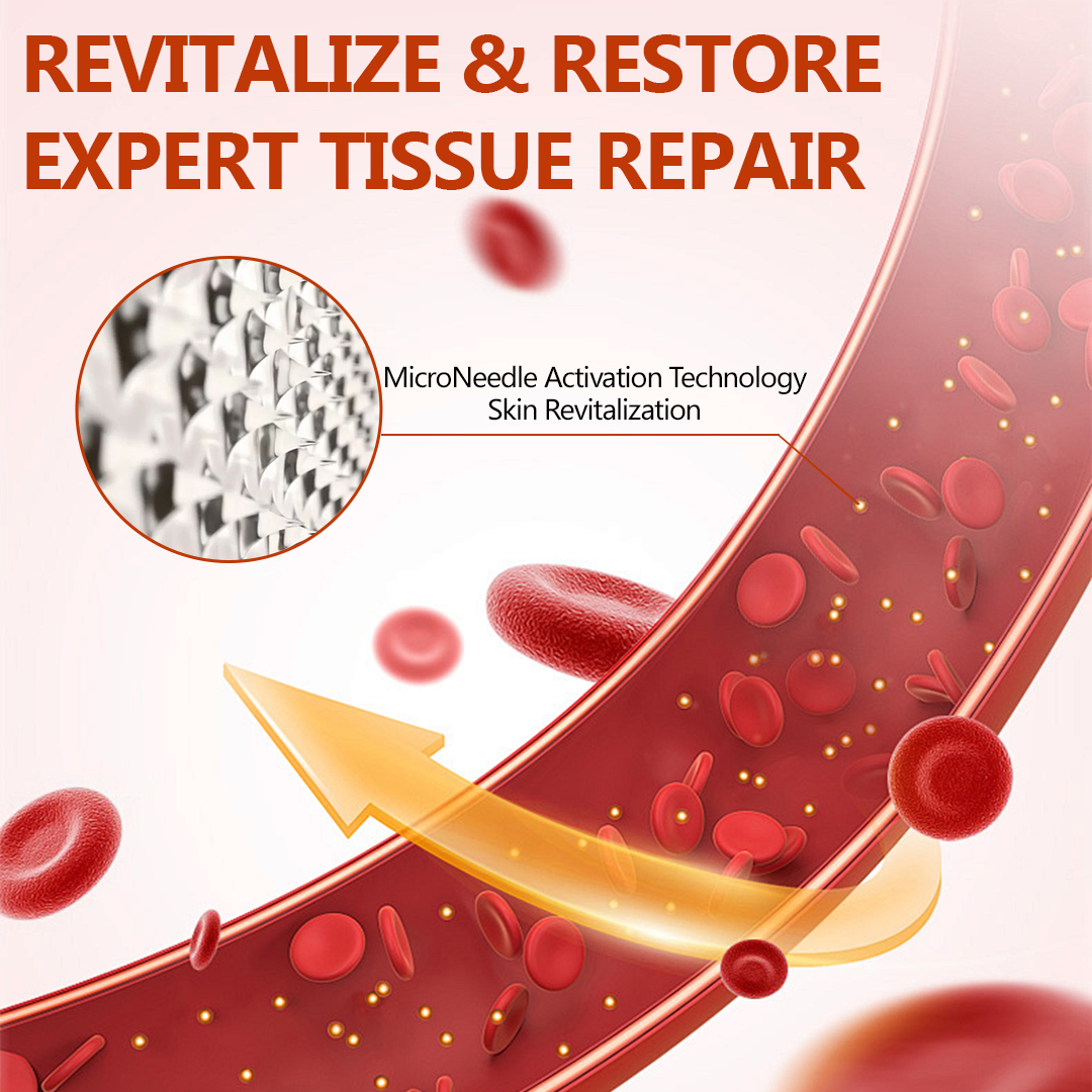 🔥 LIMITED SPECIAL OFFER🔥Timilk® VeinRepair Microneedle Patch Roll🦵✨ (Advanced Microneedle Vein Repair Patch for Bulging Veins, Swelling, Heavy Legs & Daily Leg Discomfort)