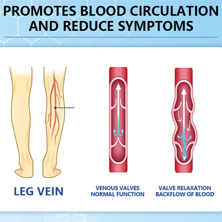 Ceoerty™ Varicose Veins Cream with Hydrogel（A)
