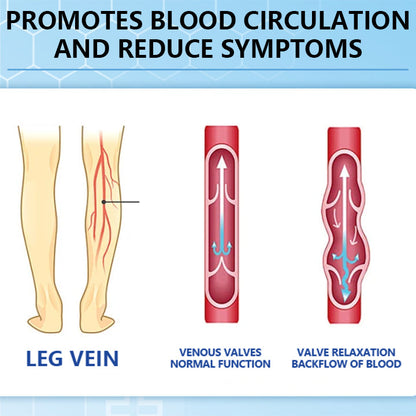 Ceoerty™ Varicose Veins Cream with Hydrogel（A)