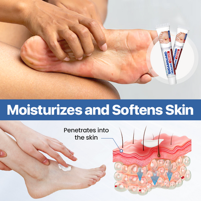 Timilk® SugarGuard Healing Cream